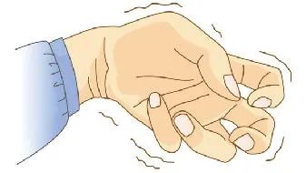 北京癫痫专科医院:癫痫的治疗方法