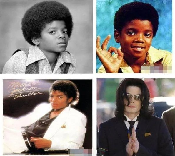 迈克尔杰克逊怎么变白的：真相是患病还是整容