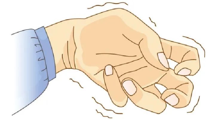 北京癫痫病医院治疗方法