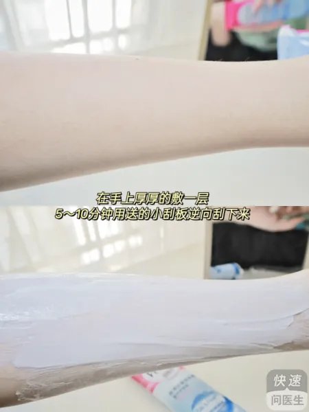 薇婷脱毛膏的脱毛效果好不好