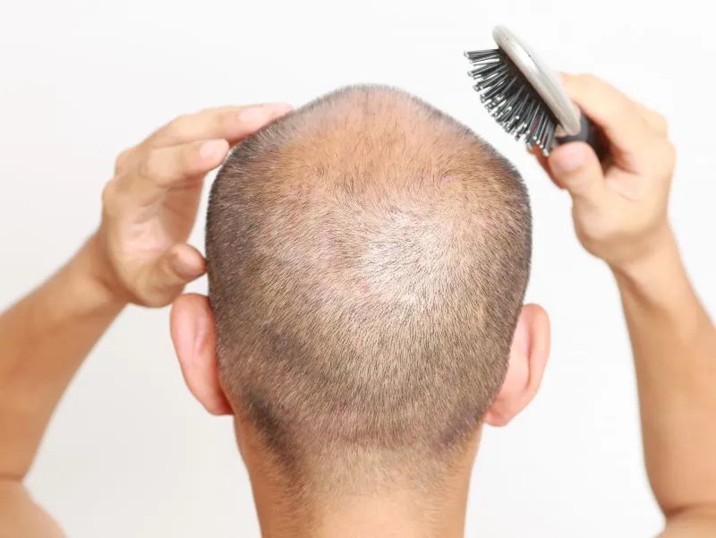 保养头发的方法