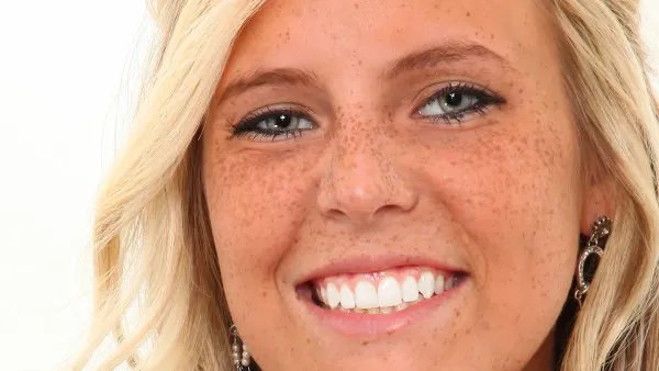 怎么祛斑,快速祛斑的方法