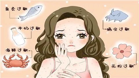 脸部过敏吃什么药