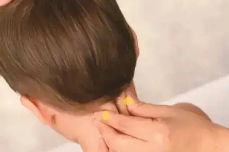 风池的功效与作用位置图