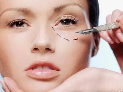 激光去眼袋多少钱