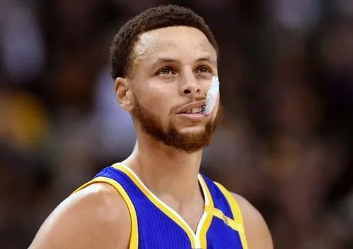 库里受伤，这是否会影响他之后的比赛？