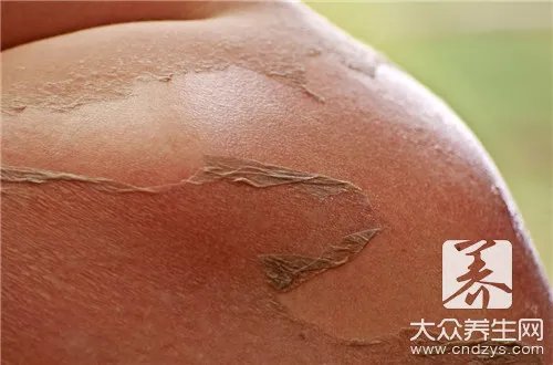 水白醋盐洗脸不会毁容吧