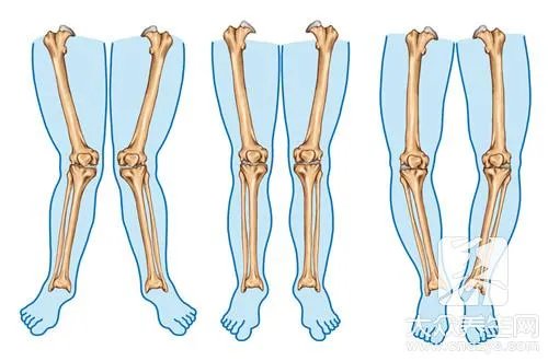 绑腿睡觉的危害