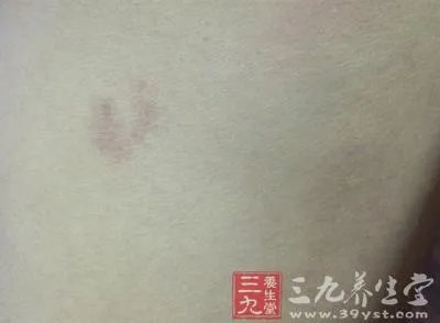 上辈子积了阴德的人身上会有它