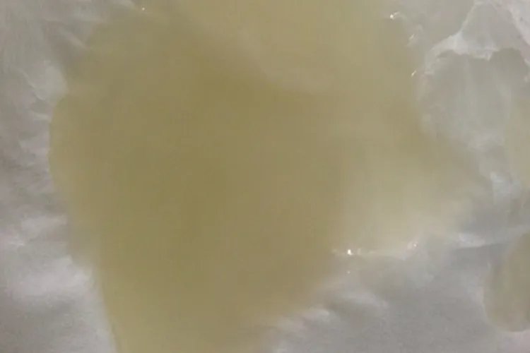 正常精是什么样的颜色