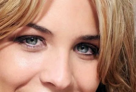 双眼皮抽脂多少钱啊