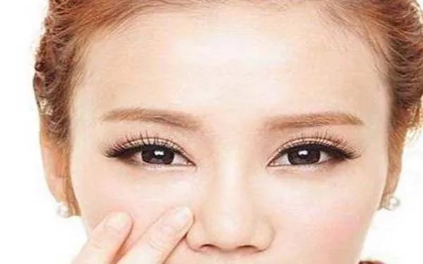 北京去眼袋哪个医院口碑好?