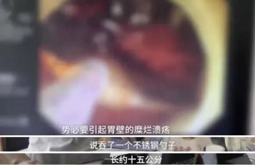 女孩醉酒吞下汤勺：回顾真相经过令人震惊又可怕