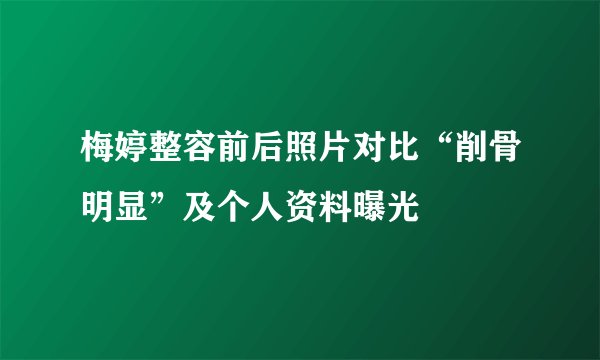 梅婷整容前后照片对比“削骨明显”及个人资料曝光