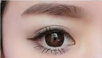 做开外眼角需要多少钱