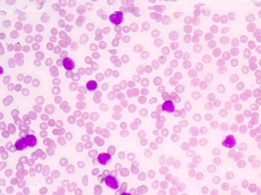 链球菌感染用什么药