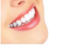 广州全瓷牙的价格是多少