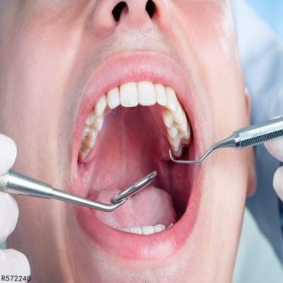 牙齿保健的方法有哪些 分享几个护牙小妙招