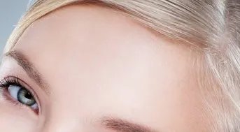 发际线移植前注意事项