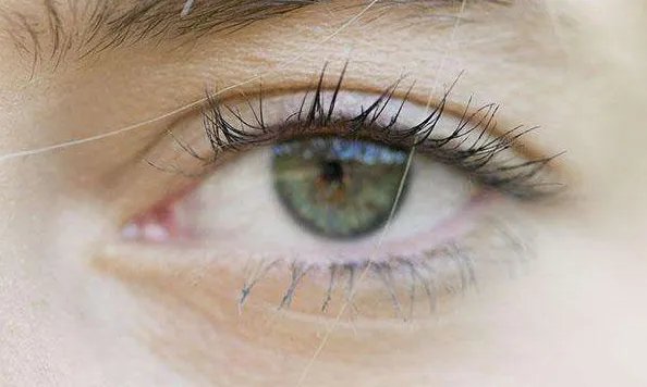 三点定位双眼皮手术多少钱