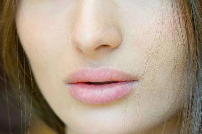 祛斑小妙招六个