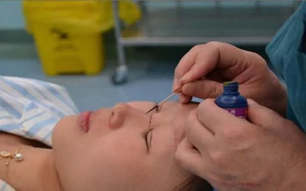 北京做耳软骨隆鼻好的医院在哪里