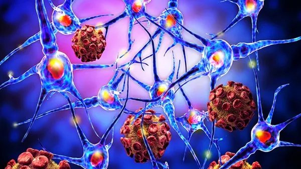 1分钟自测新冠方法 10个新冠肺炎早期症状表现都在这里