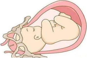 孕35周胎儿入盆图片