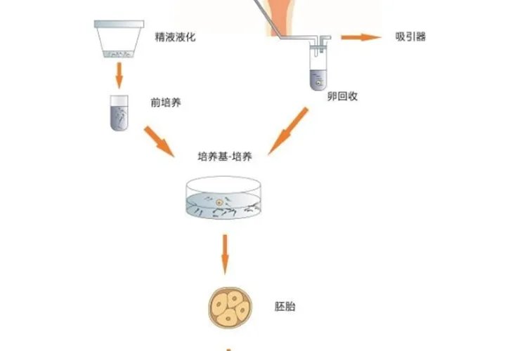 胚胎移植过程图解