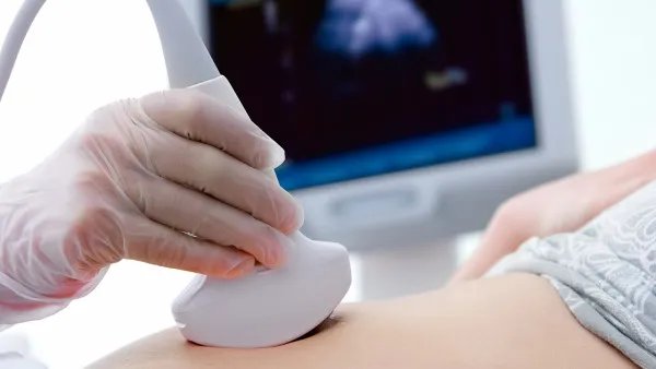 干燥综合征的饮食