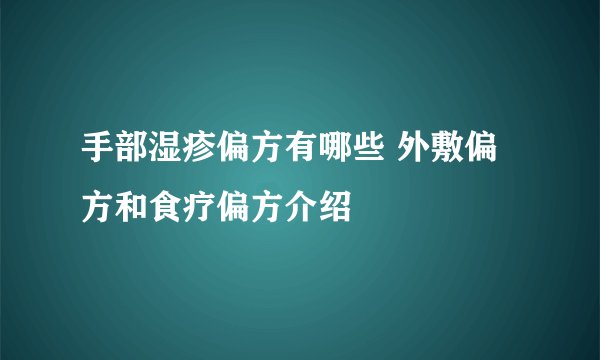 手部湿疹偏方有哪些 外敷偏方和食疗偏方介绍
