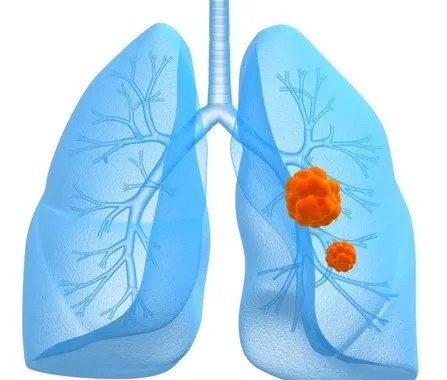 帮宝适棉柔纸尿裤新旧版本对比