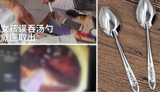 女孩醉酒吞下汤勺：回顾真相经过令人震惊又可怕