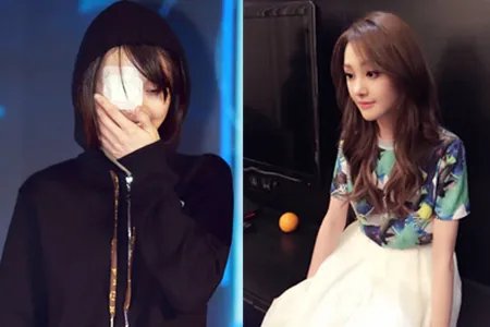 郑爽受伤后首亮相 眼睛裹着厚厚的纱布