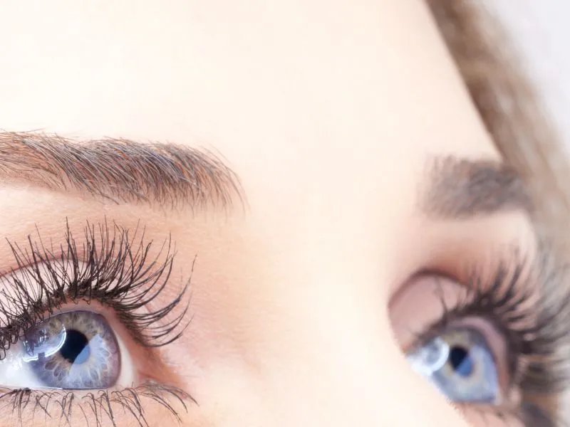 去眼角细纹的方法有哪些