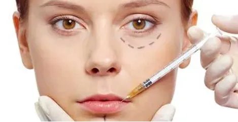 北京打玻尿酸的价格是多少