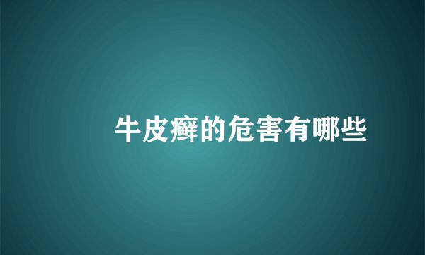 　　牛皮癣的危害有哪些