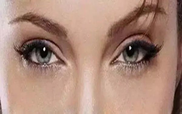 上海双眼皮需要多少钱