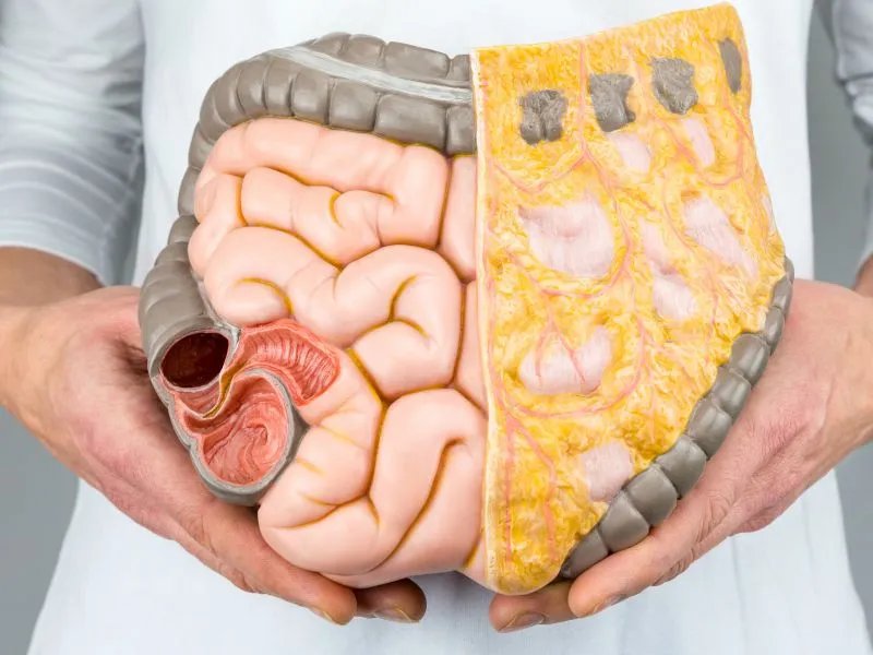 结肠损伤怎么治疗