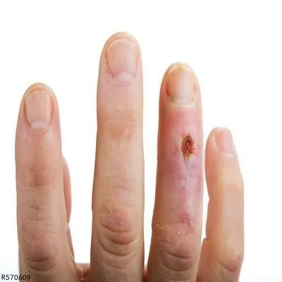 身体15个癌症信号