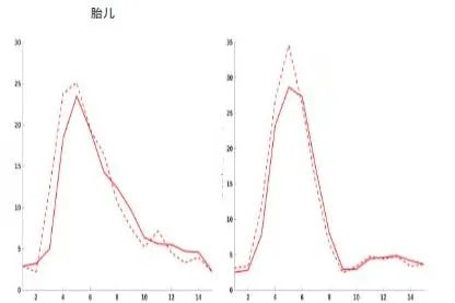 怎么看胎监报告单图