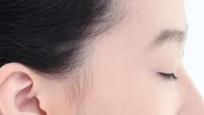 做自体脂肪丰太阳穴多少钱