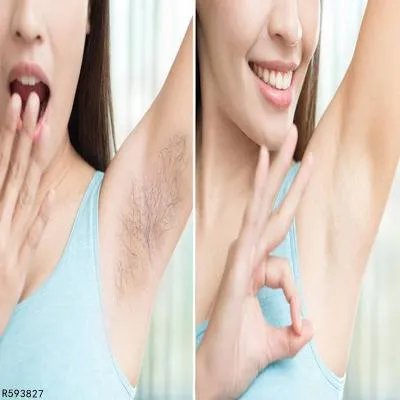 激光脱毛与光子脱毛怎么区别