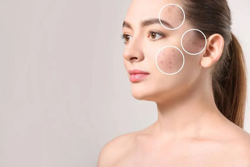 祛斑口碑最好十大排名