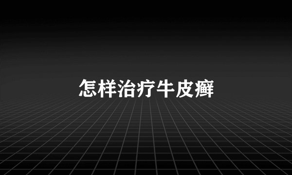 怎样治疗牛皮癣