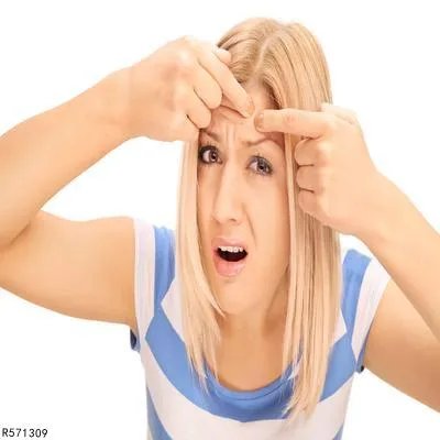 额头长痘痘怎么快速去除 额头长痘痘可用四个方法快速消除