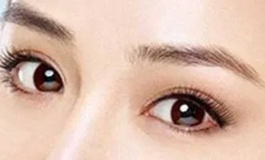 割双眼皮埋线多少钱