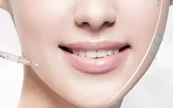 去除咬肌的方法