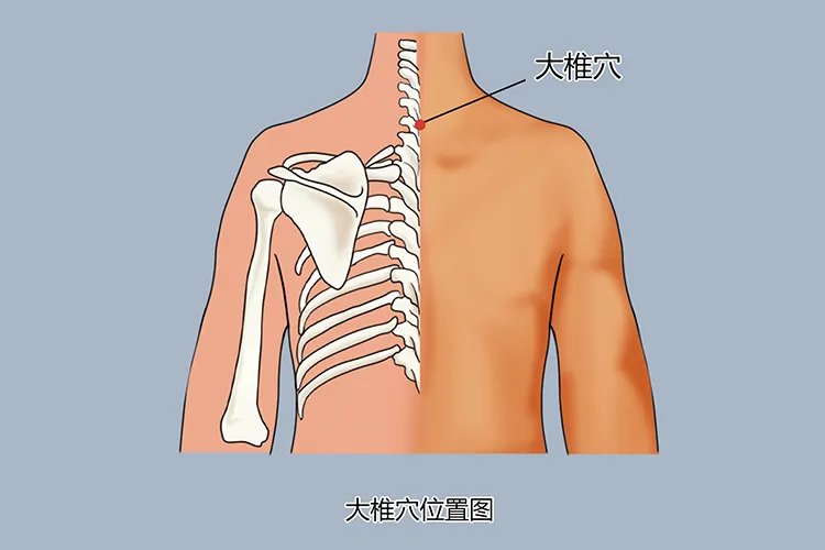 大椎的准确位置图，怎么找