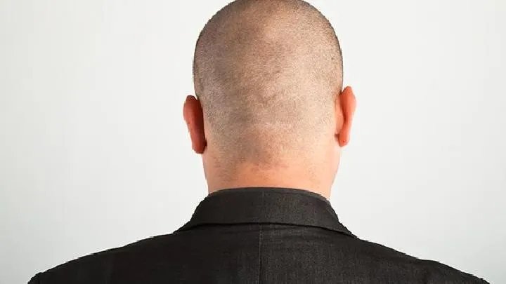 关于电脑病的症状